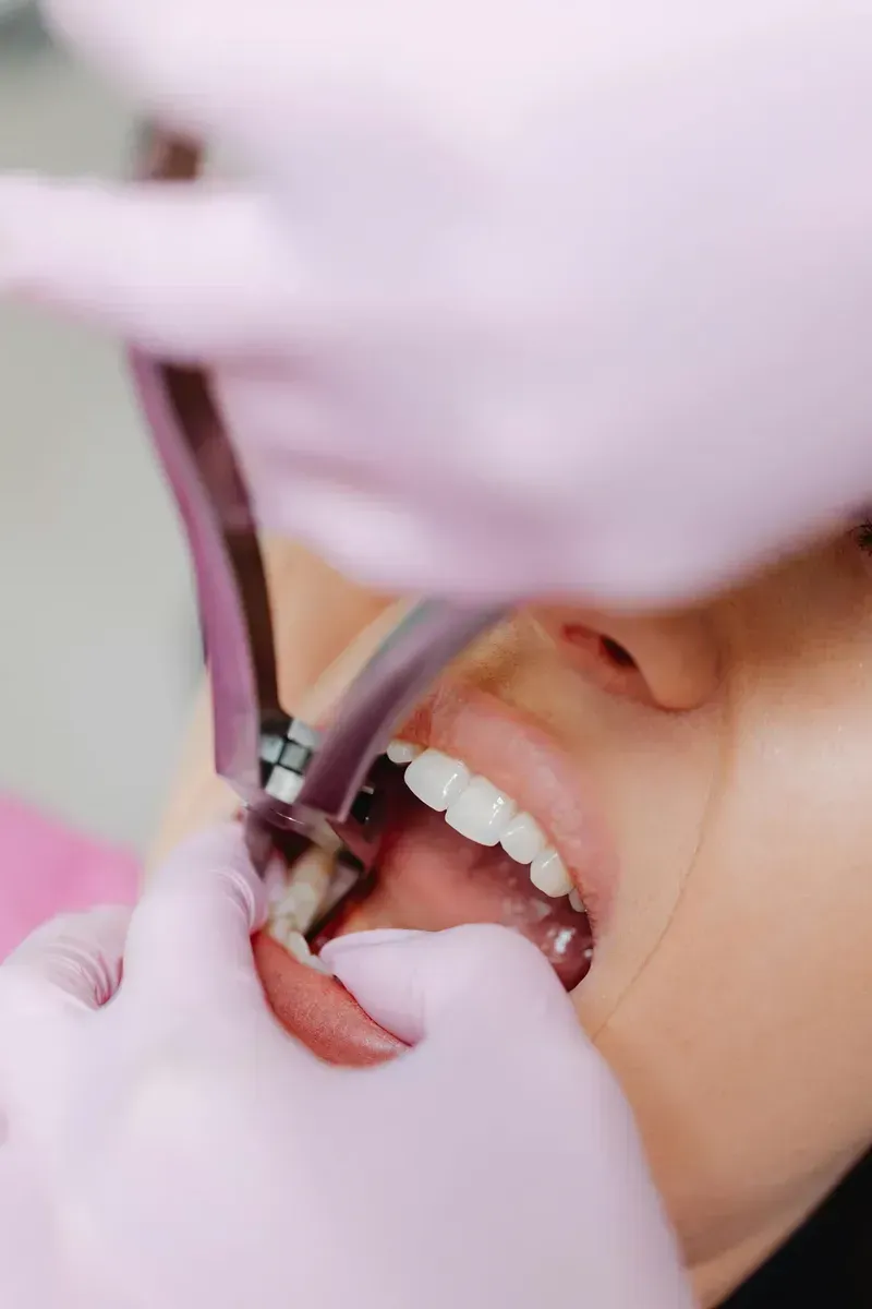 Impacted wisdom tooth surgery near me in Viman Nagar Pune at Dr. Varun's Dental Clinic